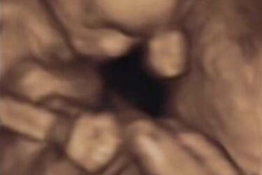 Serce Maksa może bić dzięki Tobie