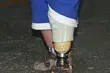 Naukowcy z Wydziału Mechanicznego PB stworzyli protezę na nóżkę dwulatka