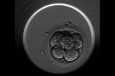 Embrioskop – światowy przełom w monitorowaniu zarodków w Białymstoku