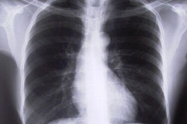 Konsultacje lekarzy i bezpłatne badania spirometryczne