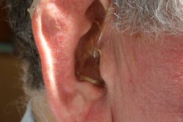 Zadbaj o swoje zdrowie. Bezpłatne badanie słuchu