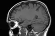 Nowocześniejszy oddział rehabilitacji neurologicznej