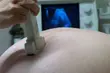 Rządowy program in vitro. Nasze kliniki w czołówce