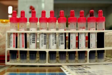 W regionie powstaje nowy budynek oddziału centrum krwiodawstwa