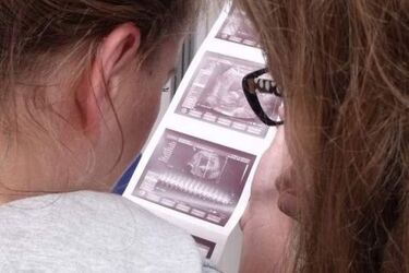 Bezpłatne badania USG i USG 4D dla kobiet w ciąży