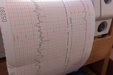 Dyżury szpitali w tym tygodniu (2-8.11). Sprawdź plan pracy placówek