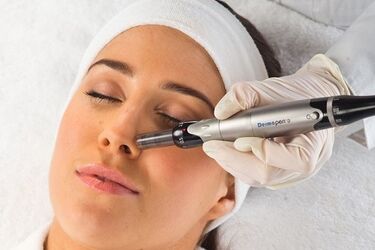 Dermapen - alternatywa dla mezoterapii i lasera. Ile taki zabieg kosztuje w białostockich gabinetach?