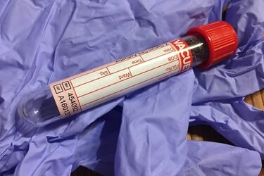 Europejski Tydzień Testowania na HIV. Każdy może zrobić badanie