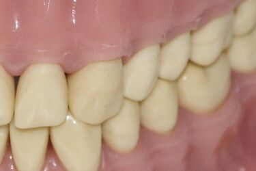 Kierowca poprosił policjantów o pomoc. Zadławił się protezą