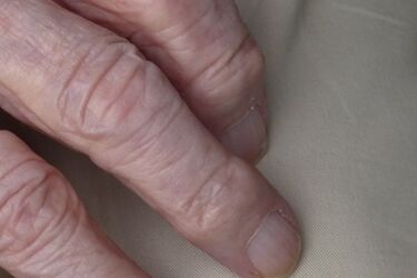 Kobieta leżała pod respiratorem, gdy przestał działać prąd