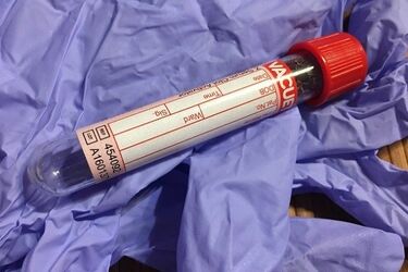 Europejski Tydzień Testowania. Można zrobić bezpłatne badania w kierunku HIV