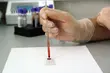 Wirus HCV. Można skorzystać z bezpłatnej diagnostyki