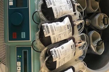 Pacjenci dziecięcej onkologii jak wampiry. Nagrali filmik [WIDEO]