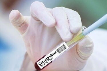 COVID-19. Liczba chorych przekroczyła 6000