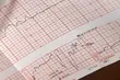 Niszczenie dokumentacji medycznej w UDSK. Pacjenci mogą składać wnioski