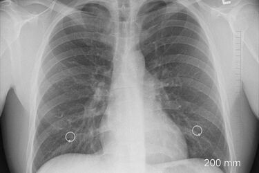 Nowe poradnie specjalistyczne w łapskim szpitalu