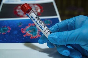 Bilans pandemii w ostatniej dobie. 4 894 nowych zakażeń w Polsce