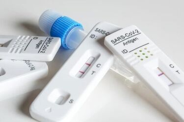 COVID-19. Wyraźnie widać tygodniowy spadek liczby zakażeń