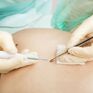 ALDERM Dermatologia i Medycyna Estetyczna 
