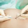 ALDERM Dermatologia i Medycyna Estetyczna 