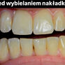 Wybielanie i higienizacja stomatologiczna Justyna Reducha