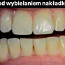 Wybielanie i higienizacja stomatologiczna Justyna Reducha