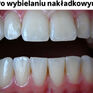 Wybielanie i higienizacja stomatologiczna Justyna Reducha