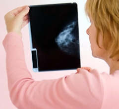 Trwa kampania "Polecam Mammografię!"