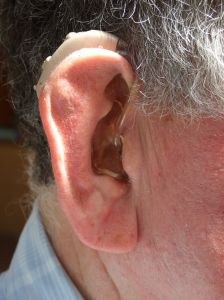 W Podlaskiem na aparat słuchowy niepełnosprawni czekają aż 4 miesiące 