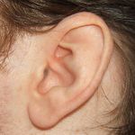 Białostoccy lekarze wszczepili pacjentowi implant słuchu. To druga taka operacja w Polsce