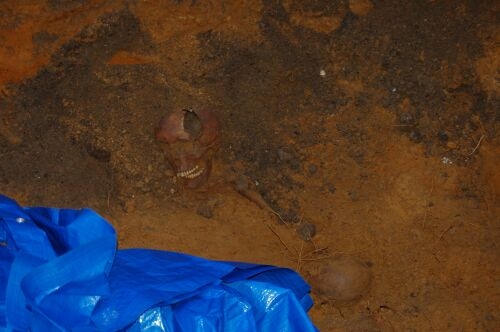 Przy areszcie śledczym znaleziono ludzkie szczątki