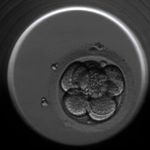Embrioskop – światowy przełom w monitorowaniu zarodków w Białymstoku