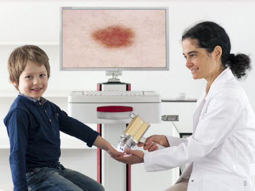 Wideodermatoskop – nowoczesne urządzenie do wczesnej diagnostyki czerniaka skóry