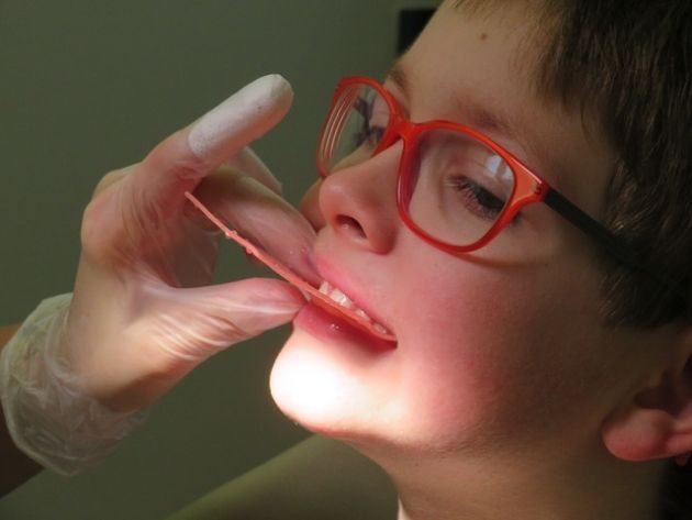 Konsultacje ortodontyczne dla dzieci i młodzieży. Będą bezpłatne badania
