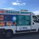 Bezpłatne badania znamion i pieprzyków. Każdy może sprawdzić kondycję swojej skóry