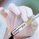 W Białymstoku potwierdzono nowe warianty koronawirusa. W tym te dotychczas nieznane