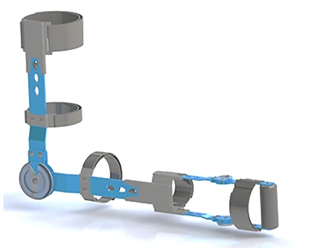 PB zdobyła kolejny patent. Tym razem na ortezę kończyny górnej
