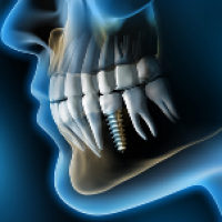 Czar-Dent Centrum Implantologii i Stomatologii Estetycznej